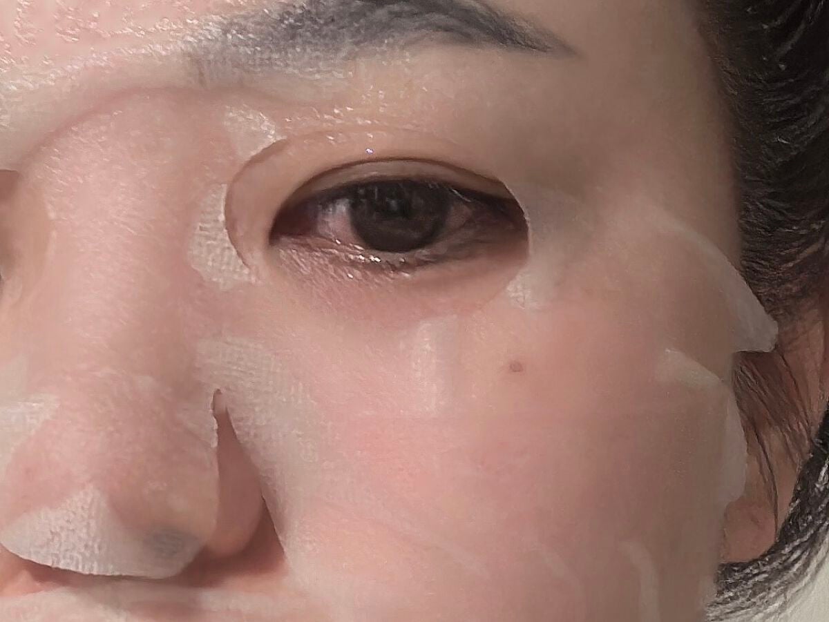 ダーマレーザー スーパーTEATREE100マスク/クオリティファースト/シートマスク・パックを使ったクチコミ(4枚目)