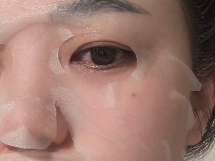 ダーマレーザー スーパーTEATREE100マスク/クオリティファースト/シートマスク・パックを使ったクチコミ(4枚目)