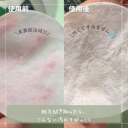 カクタストナーパッド/YADAH/トナーパッドを使ったクチコミ(9枚目)