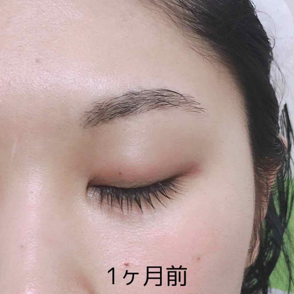 エターナルアイラッシュ/リュバンブラン/まつげ美容液を使ったクチコミ(3枚目)