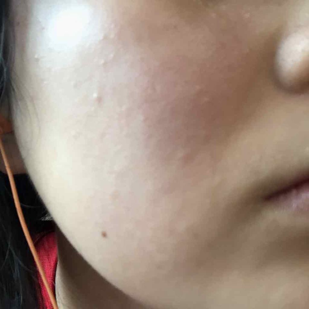 ホワイトニングクリア ローション/d プログラム/化粧水を使ったクチコミ（1枚目）