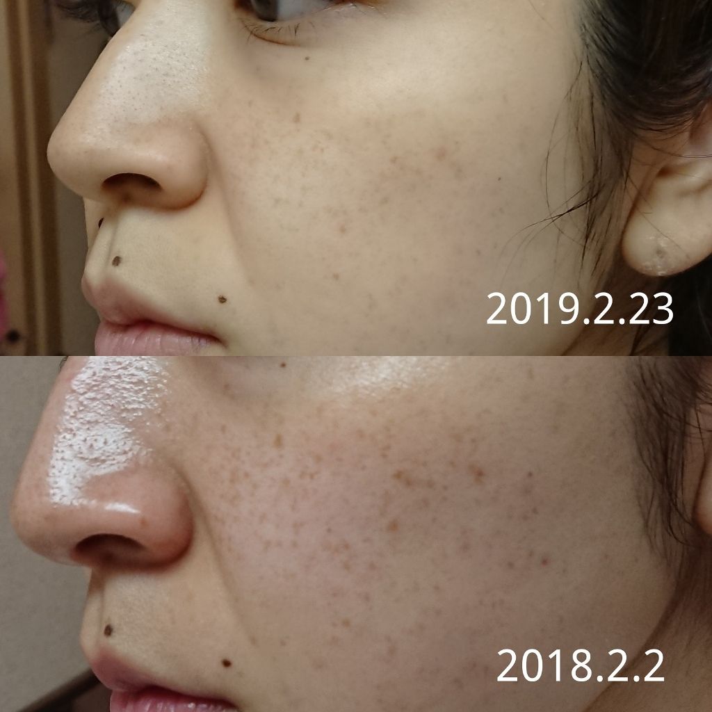 ブライトニングフォーミュラ/メコゾーム/フェイスクリームを使ったクチコミ(4枚目)