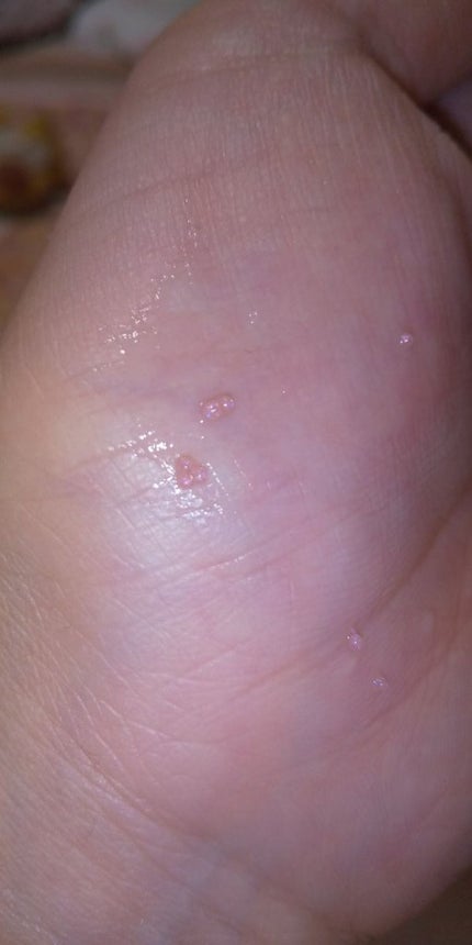 キャビアドットブースター/DEW/ブースター・導入液を使ったクチコミ(4枚目)