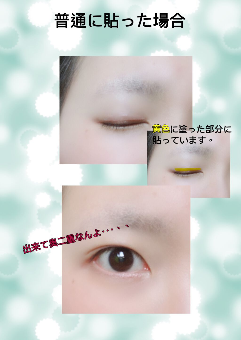 シングルアイテープ/Automatic Beauty/二重まぶた用アイテムを使ったクチコミ（2枚目）