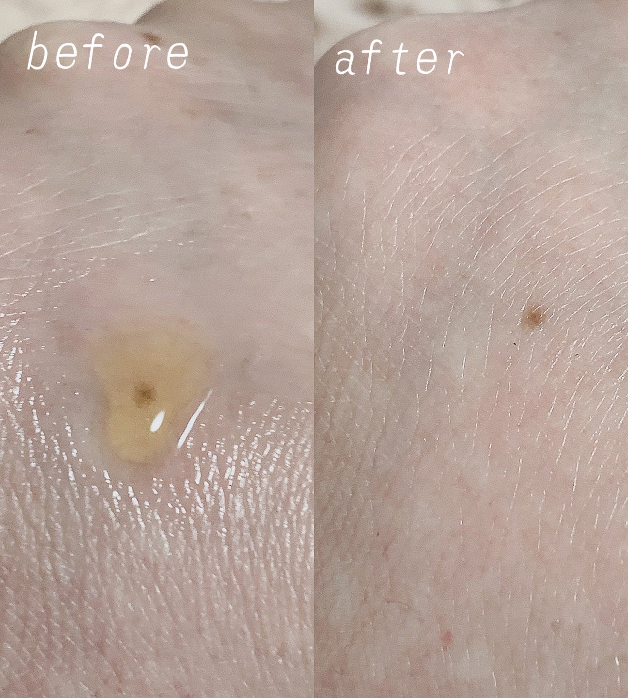 RXザ・ビタミンC23セラム/COSRX/美容液を使ったクチコミ(2枚目)