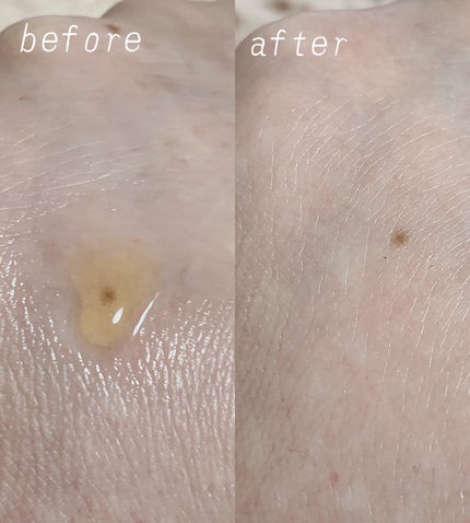 RXザ・ビタミンC23セラム/COSRX/美容液を使ったクチコミ(2枚目)