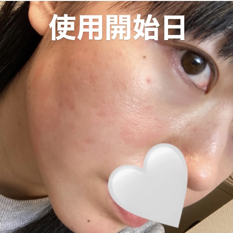 セラム ヴェール/ONE BY KOSE/美容液を使ったクチコミ（2枚目）