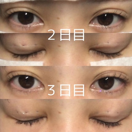 ニャルラトホテプ on LIPS 「前回アイテープで二重にする方法を投稿したばっかりですが5日1日..」(4枚目)