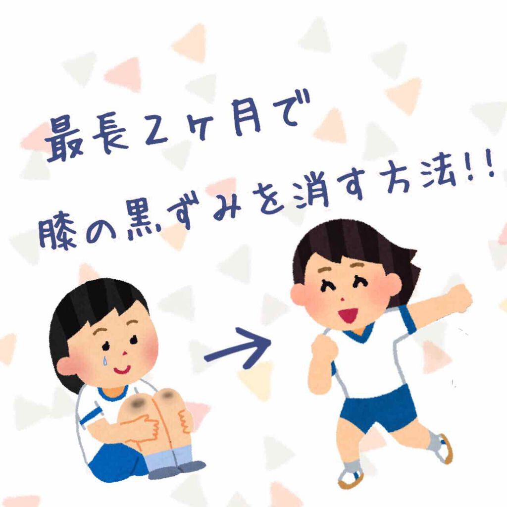 薬用美白 クリーム/DAISO/フェイスクリームを使ったクチコミ(1枚目)