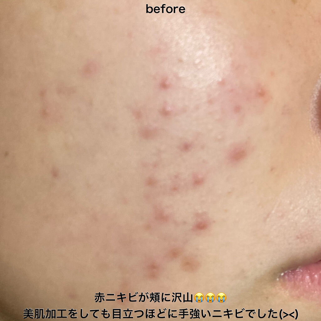 CICA ケアクリーム/BEAUSTA/フェイスクリームを使ったクチコミ（3枚目）