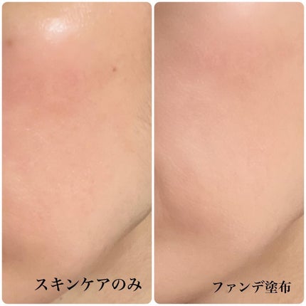 を使ったクチコミ(3枚目)