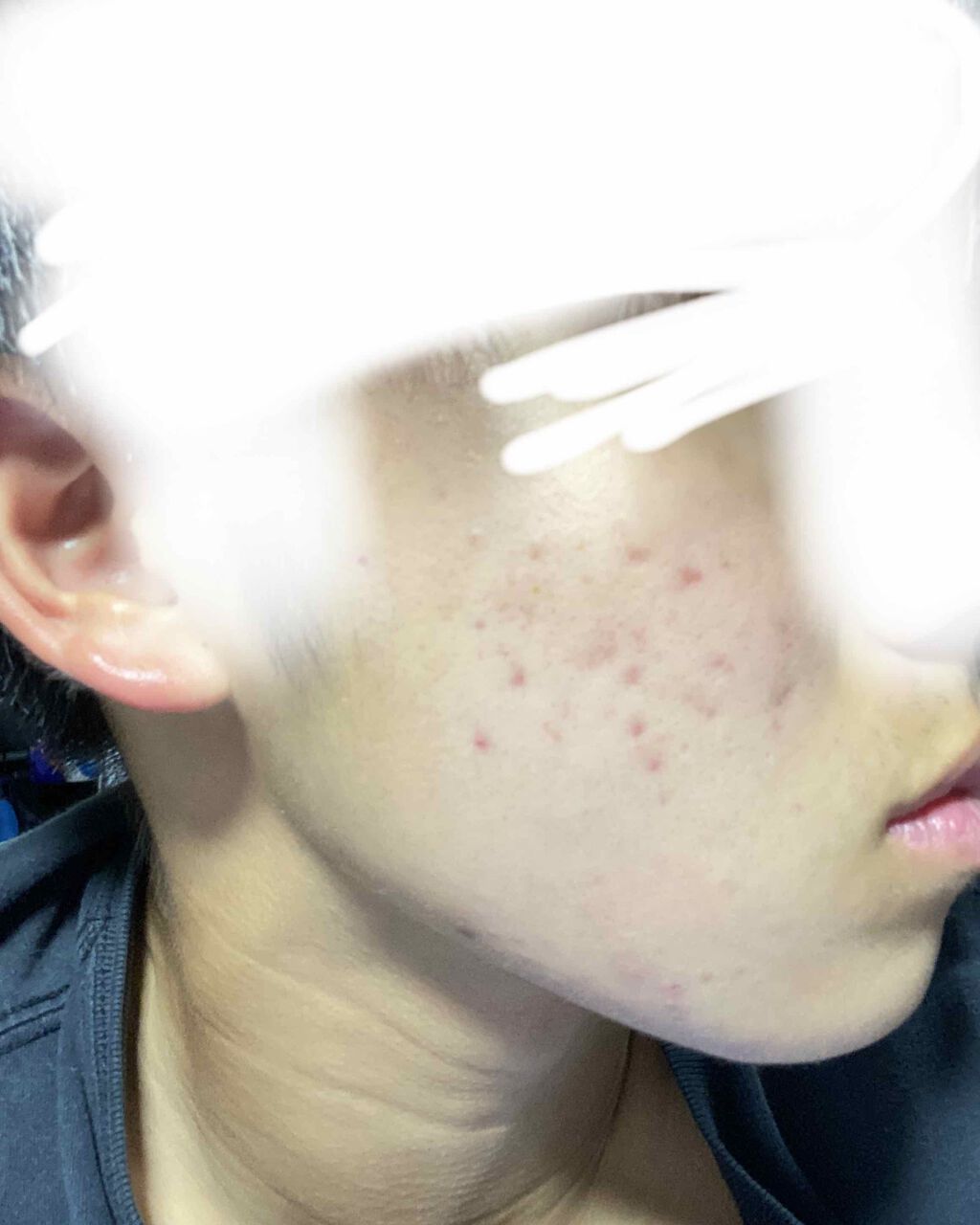 ハトムギ化粧水(ナチュリエ スキンコンディショナー R )/ナチュリエ/化粧水を使ったクチコミ（2枚目）