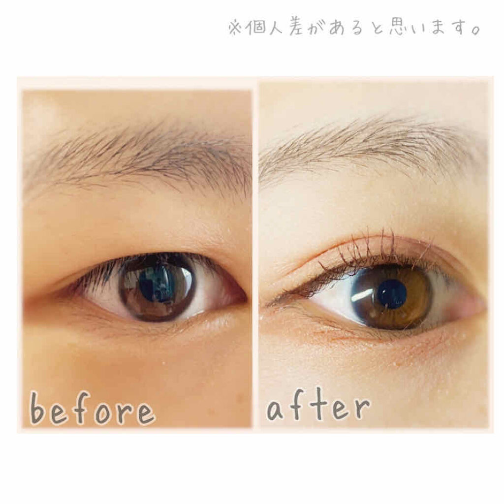 のびーるアイテープ（絆創膏タイプ、レギュラー）/DAISO/二重まぶた用アイテムを使ったクチコミ（2枚目）