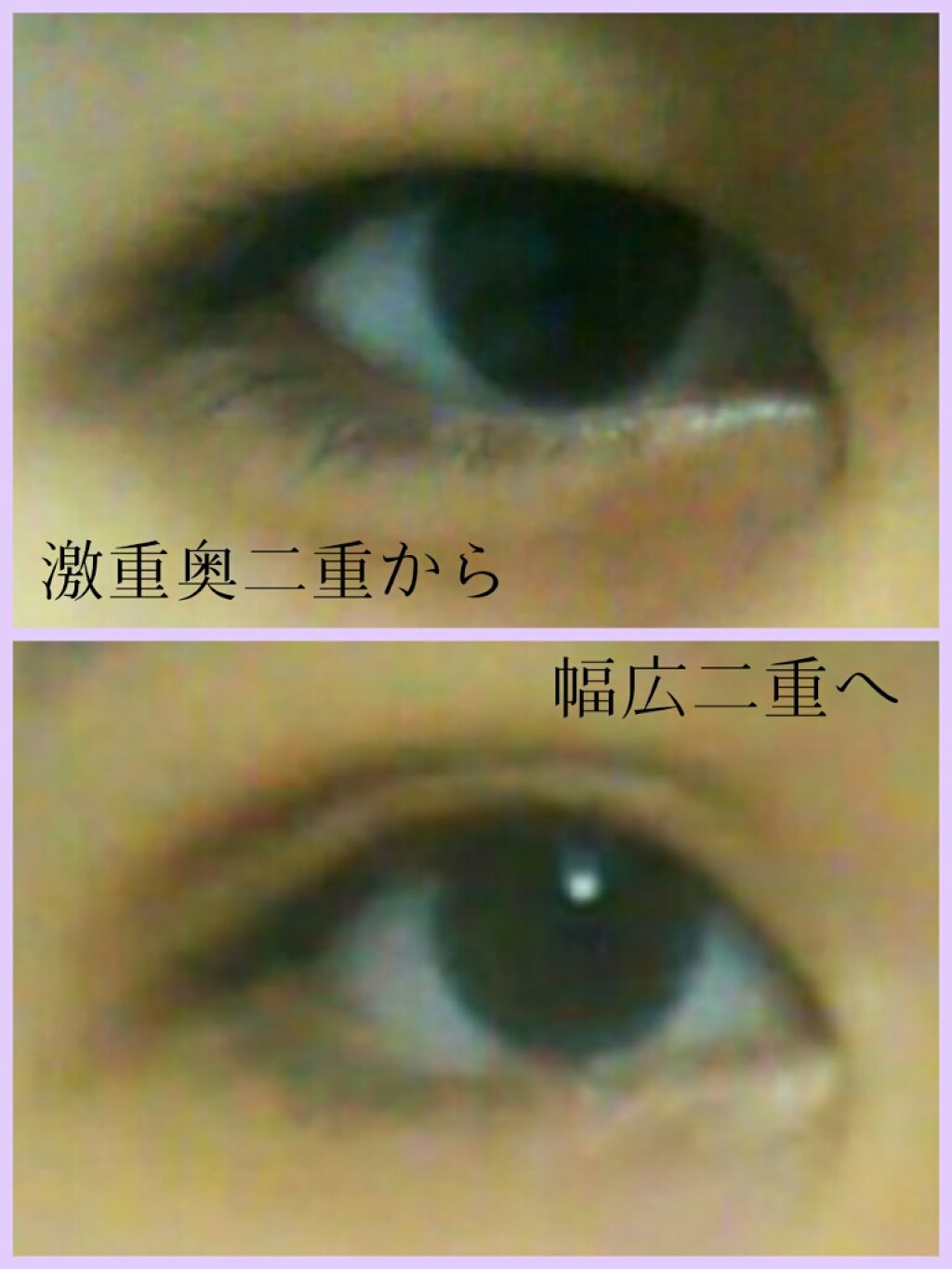 のびーるアイテープ(絆創膏タイプ、レギュラー)/DAISO/二重まぶた用アイテムを使ったクチコミ(1枚目)