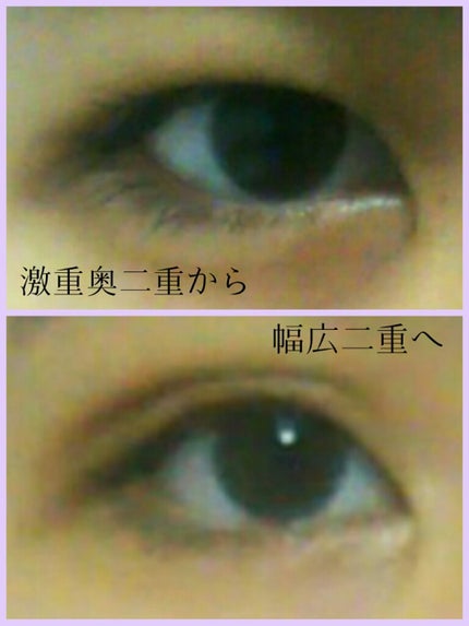 のびーるアイテープ(絆創膏タイプ、レギュラー)/DAISO/二重まぶた用アイテムを使ったクチコミ(1枚目)