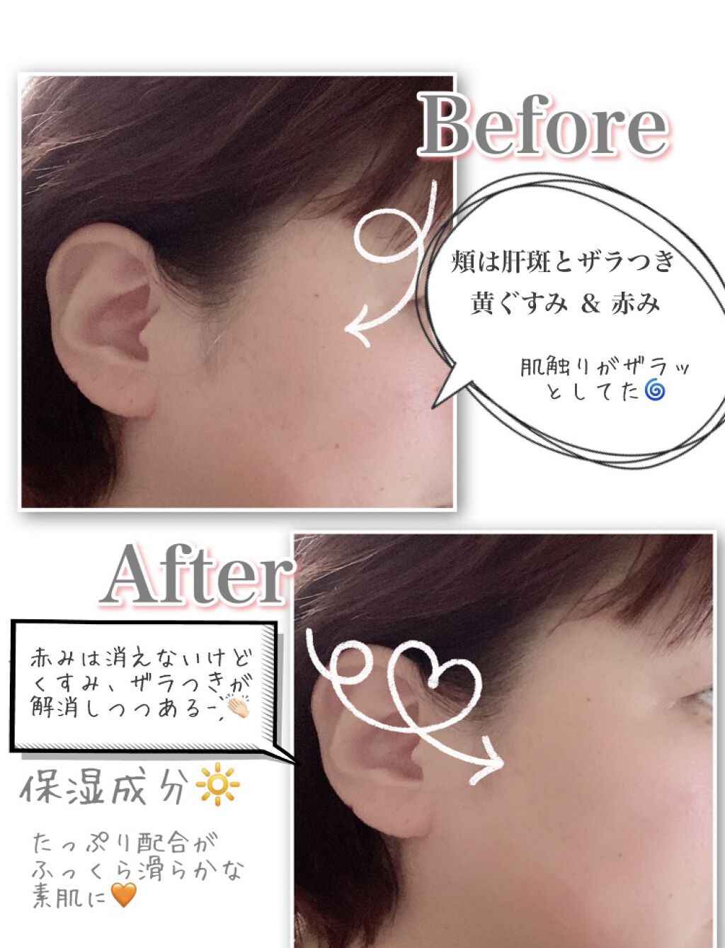 を使ったクチコミ（1枚目）