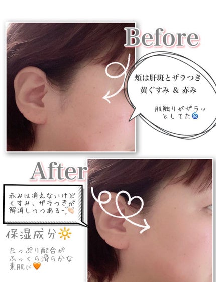 を使ったクチコミ(1枚目)