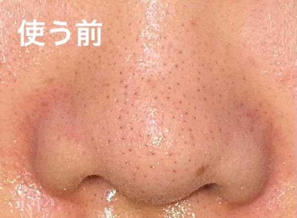Мэи on LIPS 「こんにちは!2連続の投稿になります𓂃𓈒𓏸今回は話題のビタミン..」(5枚目)