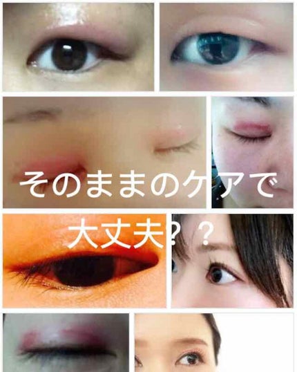 アイトーク クリアジェル/アイトーク/二重まぶた用アイテムを使ったクチコミ(1枚目)