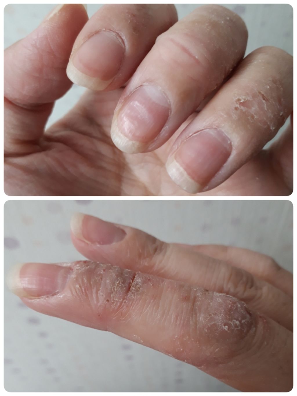 ワセリン/ピジョン/ボディクリームを使ったクチコミ（2枚目）