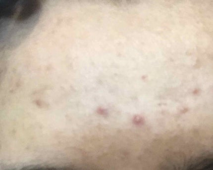 EclatCharme(エクラシャルム)/FABIUS/オールインワン化粧品を使ったクチコミ(2枚目)