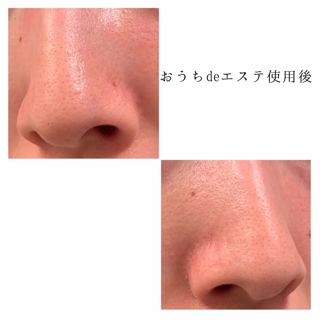 パワーマスク SP/ラッシュ/スクラブ・ゴマージュを使ったクチコミ（3枚目）