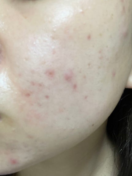 ã䜿ã£ãã¯ãã³ãïŒ3æç®ïŒ