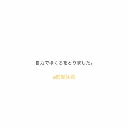 加香ひまし油(医薬品)/日本薬局方/その他を使ったクチコミ(1枚目)