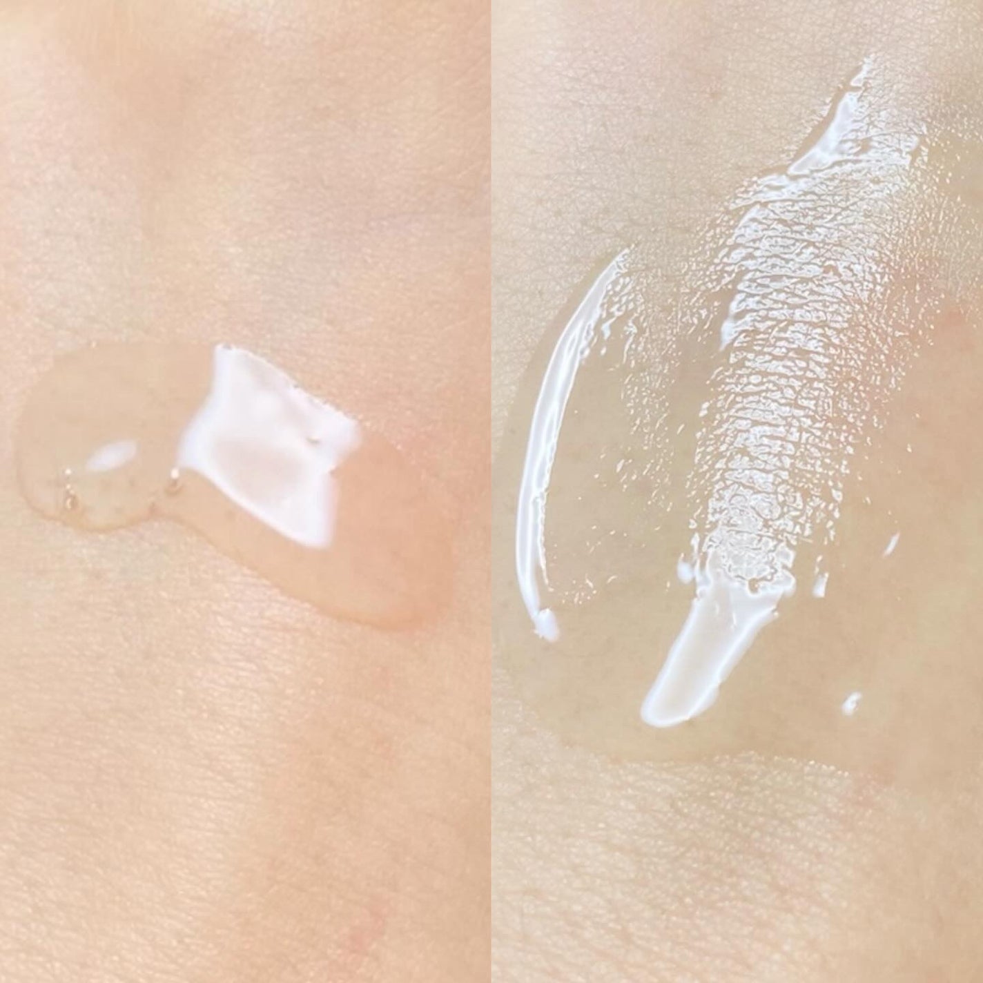 TXトーニングエッセンス1000SHOT/VT/美容液を使ったクチコミ(3枚目)