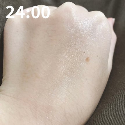 ハイポアレジェニック シカ クリーム/Dermatory/フェイスクリームを使ったクチコミ(5枚目)