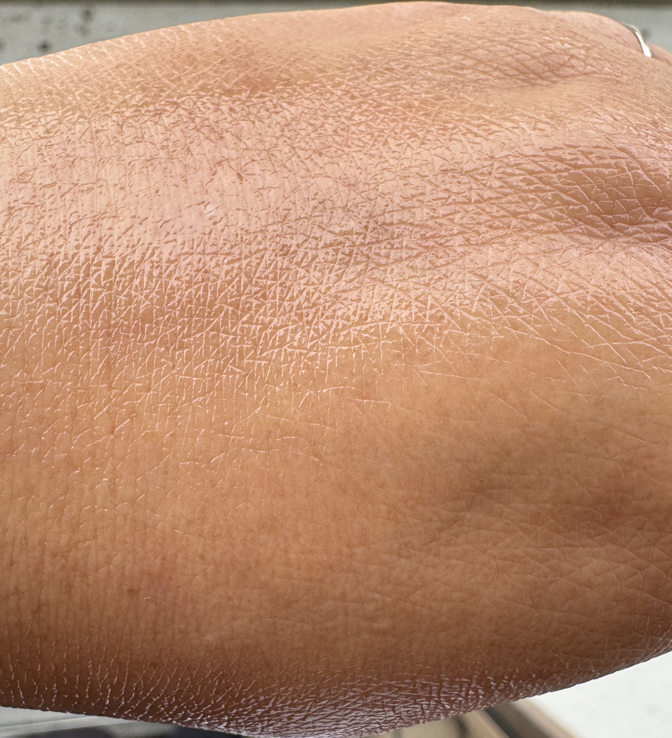 プロバイオシカ インテンシブ アンプル/SKIN1004/美容液を使ったクチコミ（2枚目）