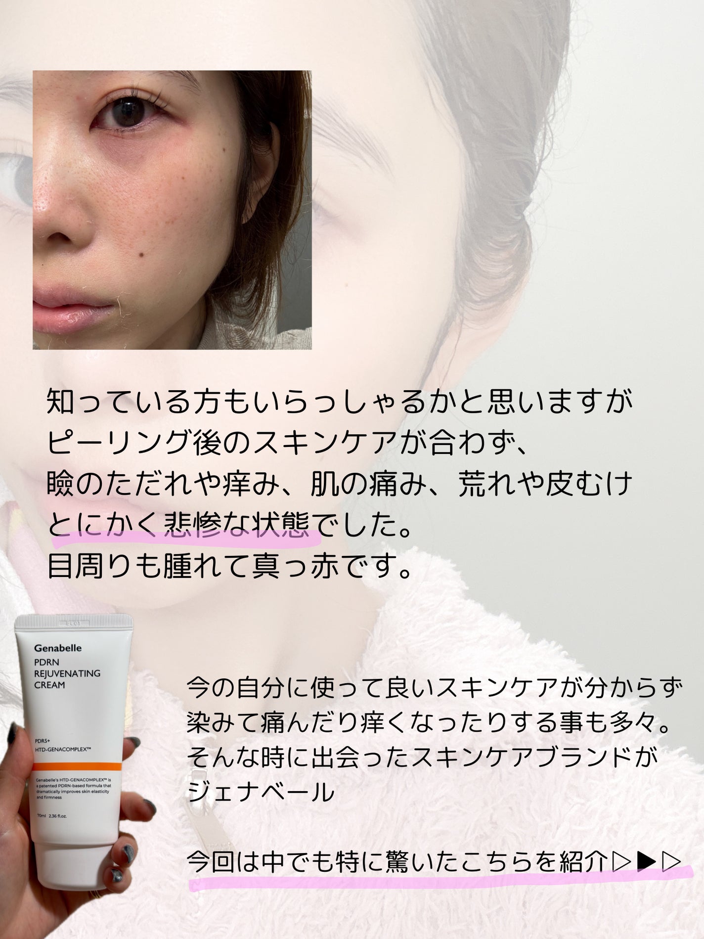 PDRNリジュビネイティングクリーム/Genabelle/フェイスクリームを使ったクチコミ(2枚目)