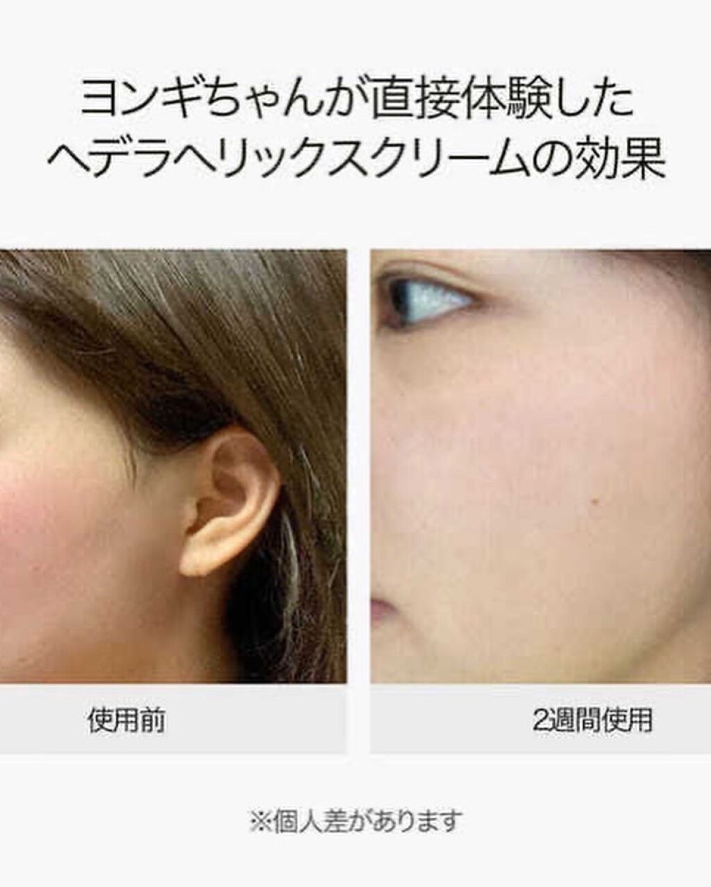 ヘデラヘリックス バランスクリーム/Milk Touch/フェイスクリームを使ったクチコミ(6枚目)