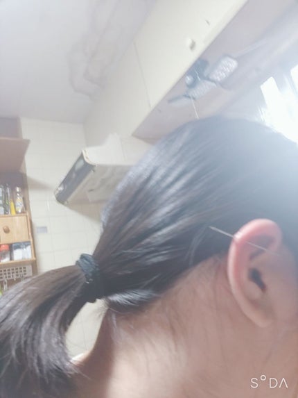 オロナインH軟膏 (医薬品)/オロナイン/その他を使ったクチコミ(3枚目)