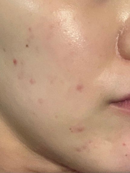 クリスタルパウダー/TOUT VERT/その他スキンケアを使ったクチコミ(1枚目)