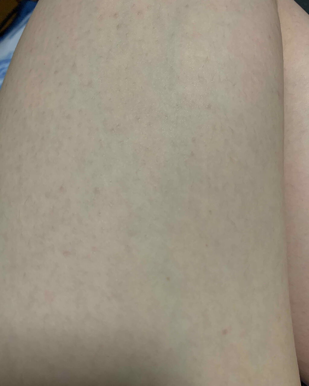 皮脂トラブルケア 化粧水/キュレル/化粧水を使ったクチコミ（3枚目）