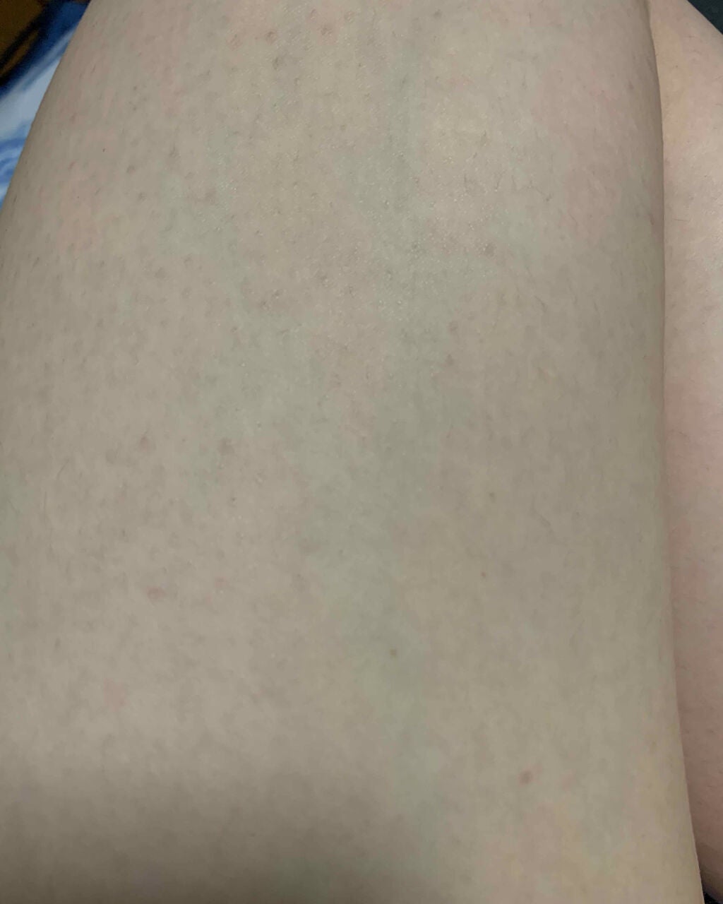 皮脂トラブルケア 化粧水/キュレル/化粧水を使ったクチコミ(3枚目)