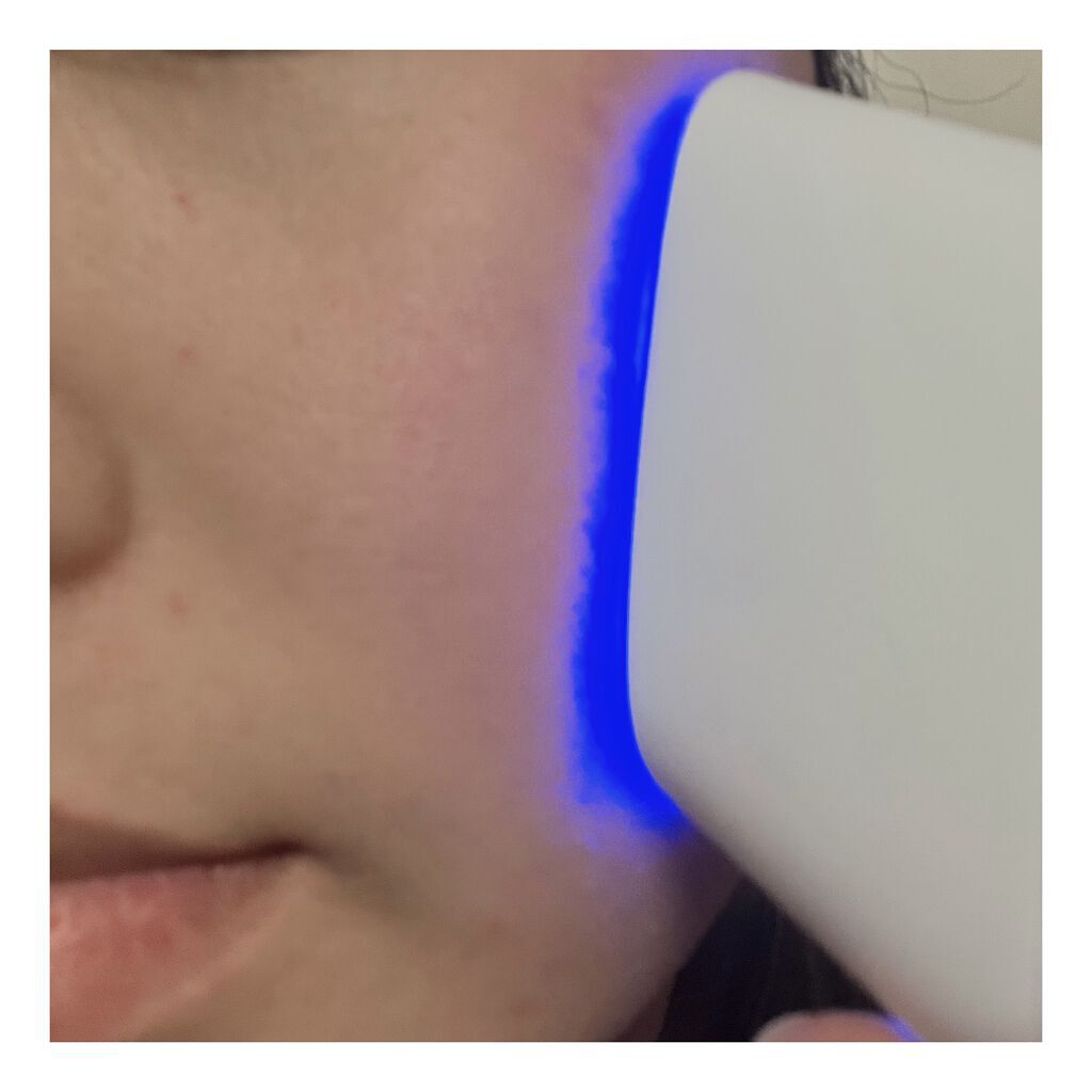 スキンライトセラピーII/Makeon/美顔器・マッサージを使ったクチコミ（2枚目）