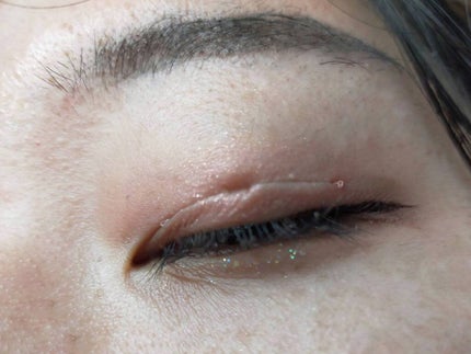 アクティブアイトークII/アイトーク/二重まぶた用アイテムを使ったクチコミ(2枚目)