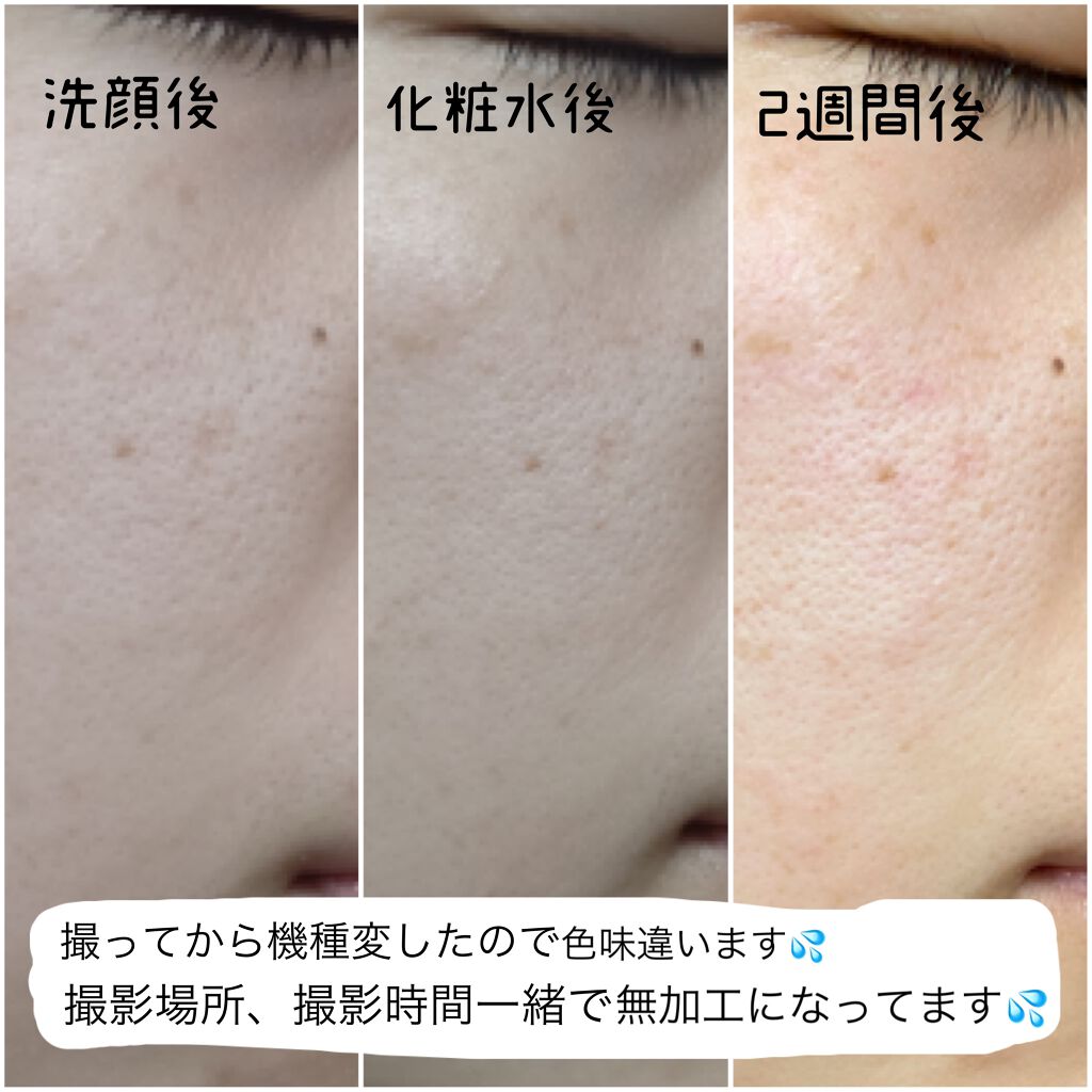 クリアウェルネス ナチュラル ドリップ/雪肌精/化粧水を使ったクチコミ（3枚目）