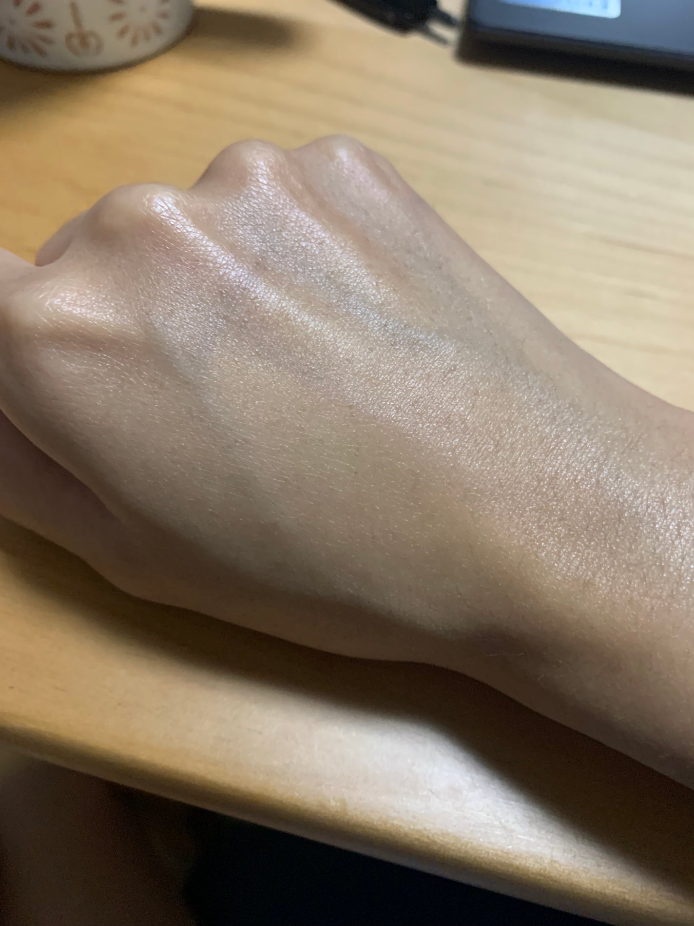 ヒアルーシカ ウォーターフィット サンセラム/SKIN1004/日焼け止めローションを使ったクチコミ(3枚目)