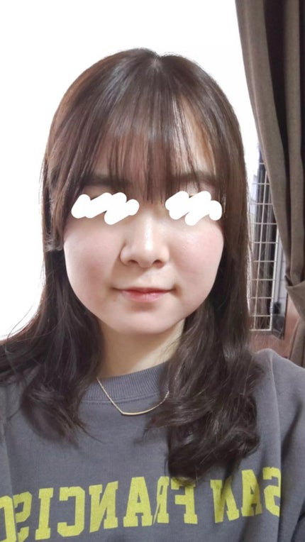 エピデュオゲル/美容皮膚科/フェイスクリームを使ったクチコミ(3枚目)