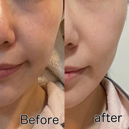 まいたむ on LIPS 「Dr.ArrivoZeusIIをついにお迎えしました🥹✨美顔器..」(4枚目)