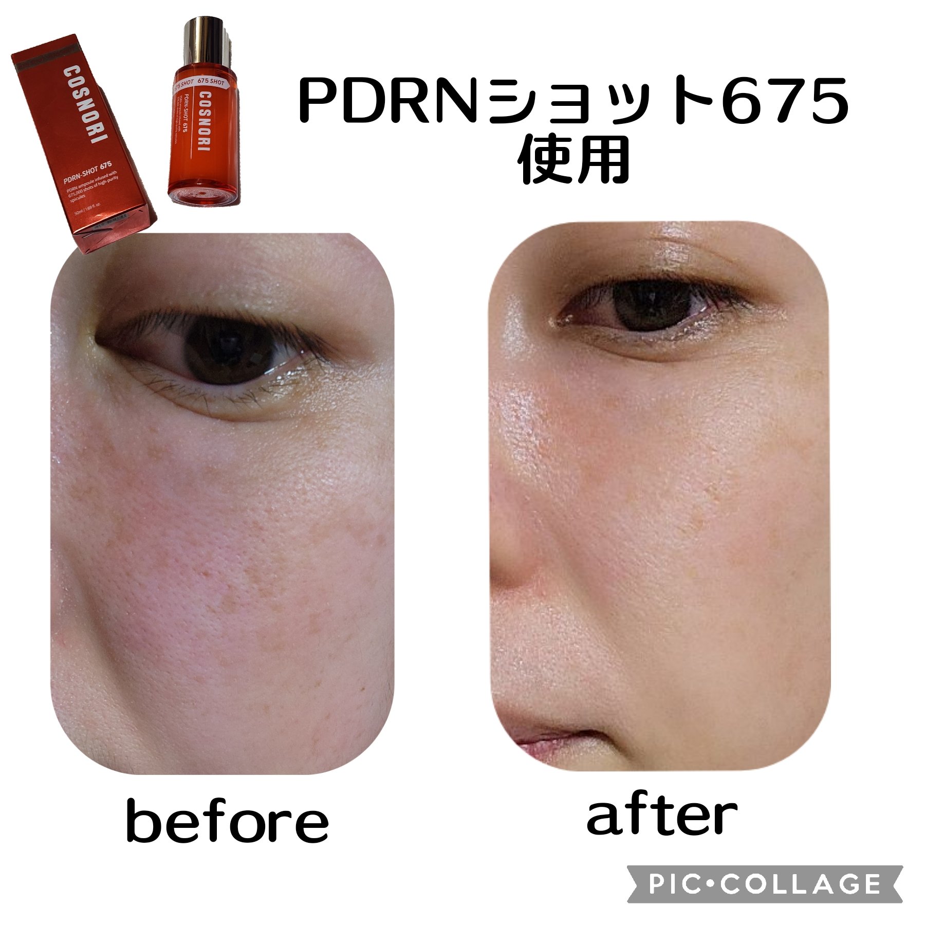 PDRNショット675/COSNORI/美容液を使ったクチコミ（3枚目）