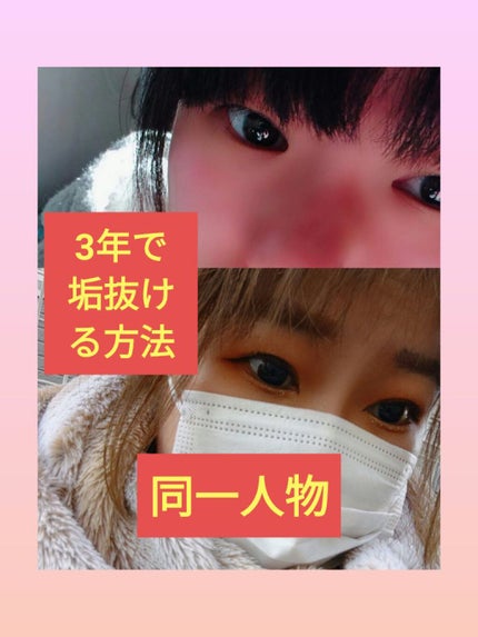 を使ったクチコミ(1枚目)