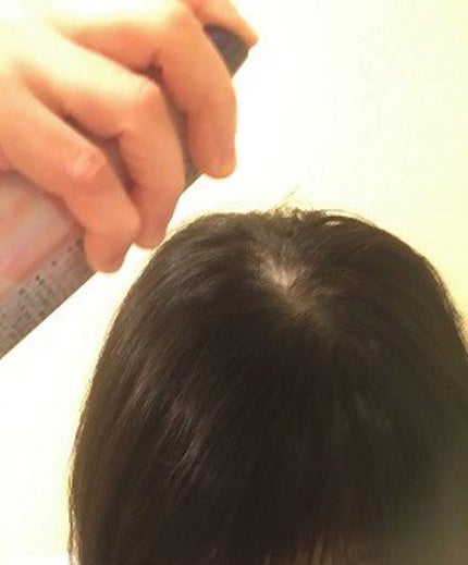 育毛スプレー ボリュームケア/セグレタ/頭皮ローションを使ったクチコミ(1枚目)
