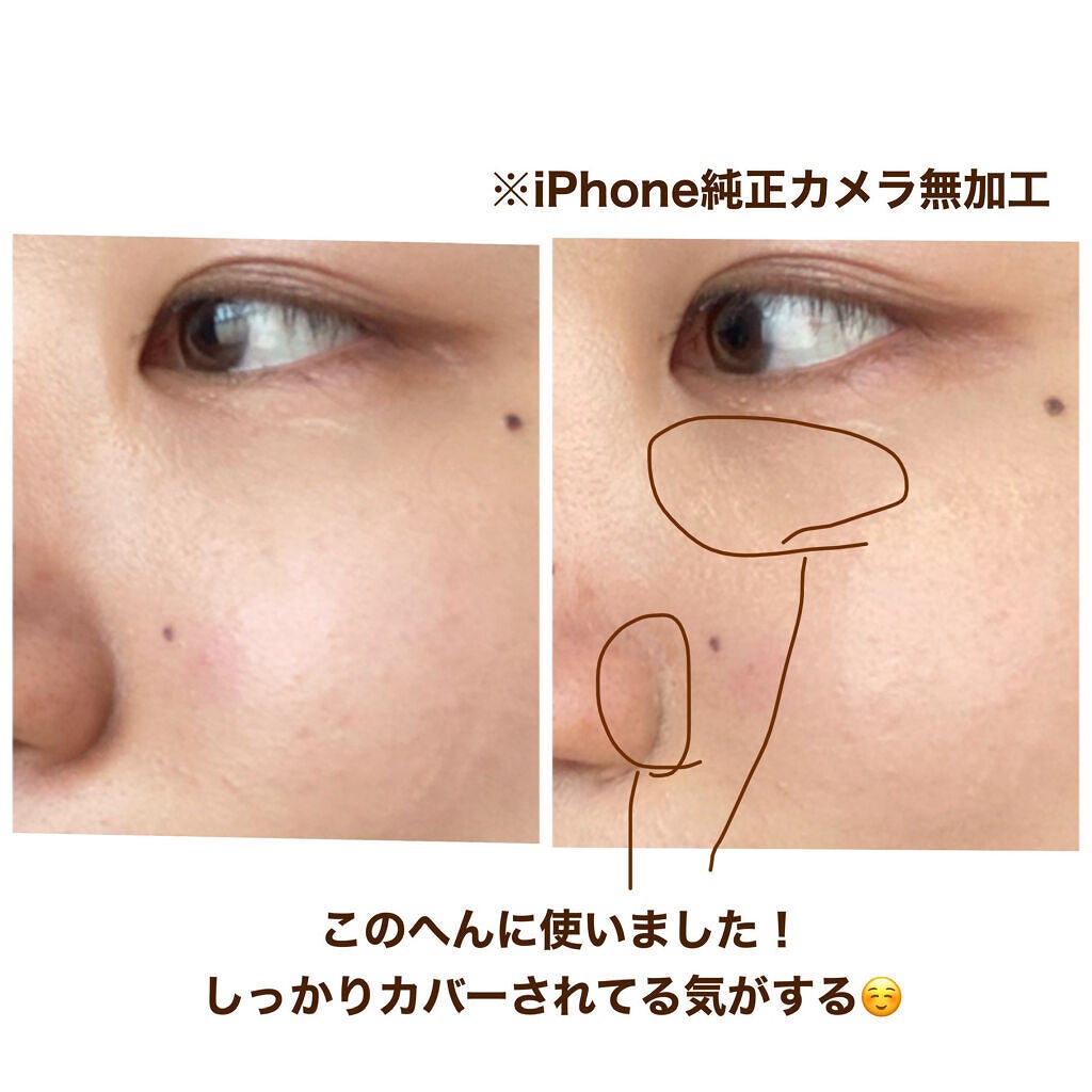 モイストラボ エッセンス薬用美白コンシーラー/Moist Labo/リキッドコンシーラーを使ったクチコミ(6枚目)