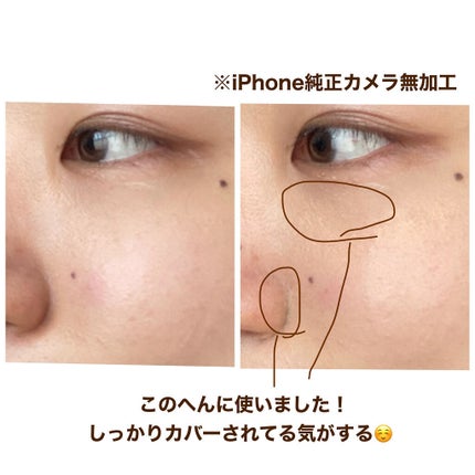 モイストラボ エッセンス薬用美白コンシーラー/Moist Labo/リキッドコンシーラーを使ったクチコミ(6枚目)