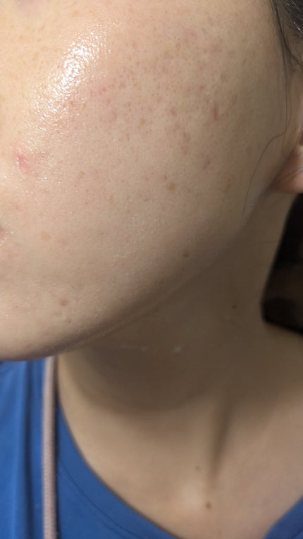 オリーブヤング ケアプラス/Olive Young/その他を使ったクチコミ(2枚目)