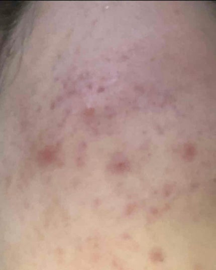 を使ったクチコミ(2枚目)